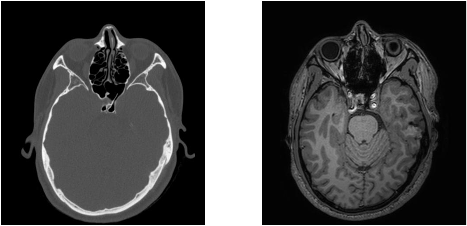 ct_mri