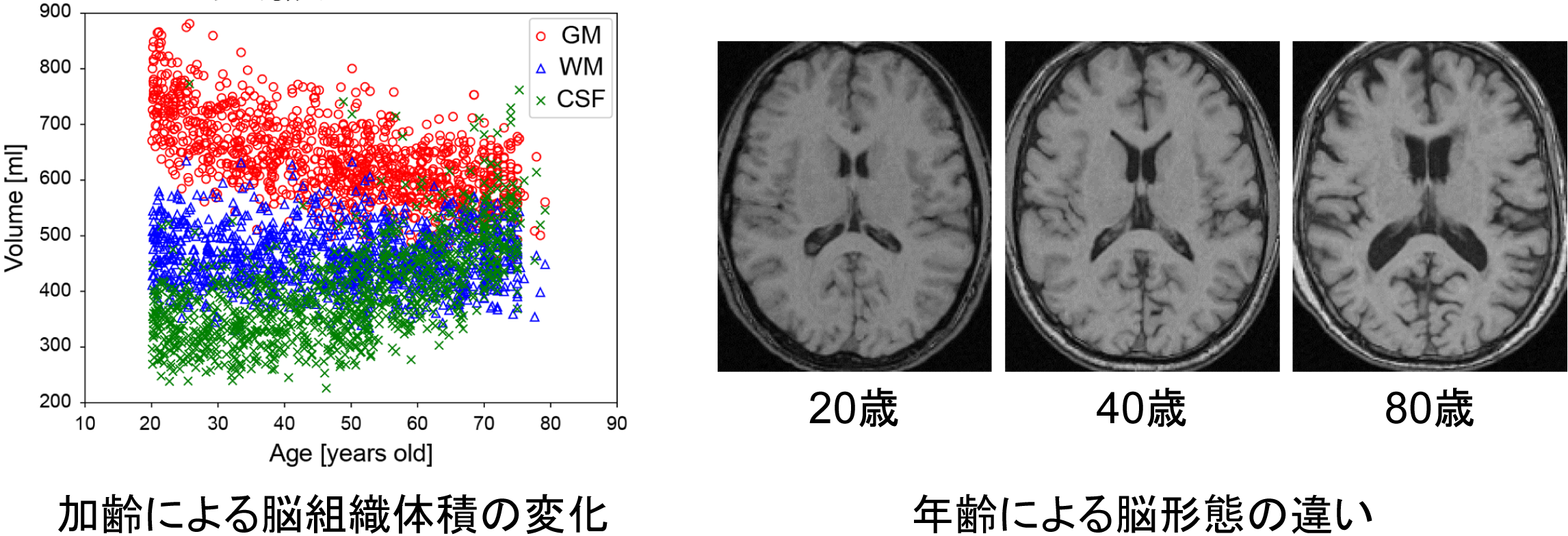brain_age