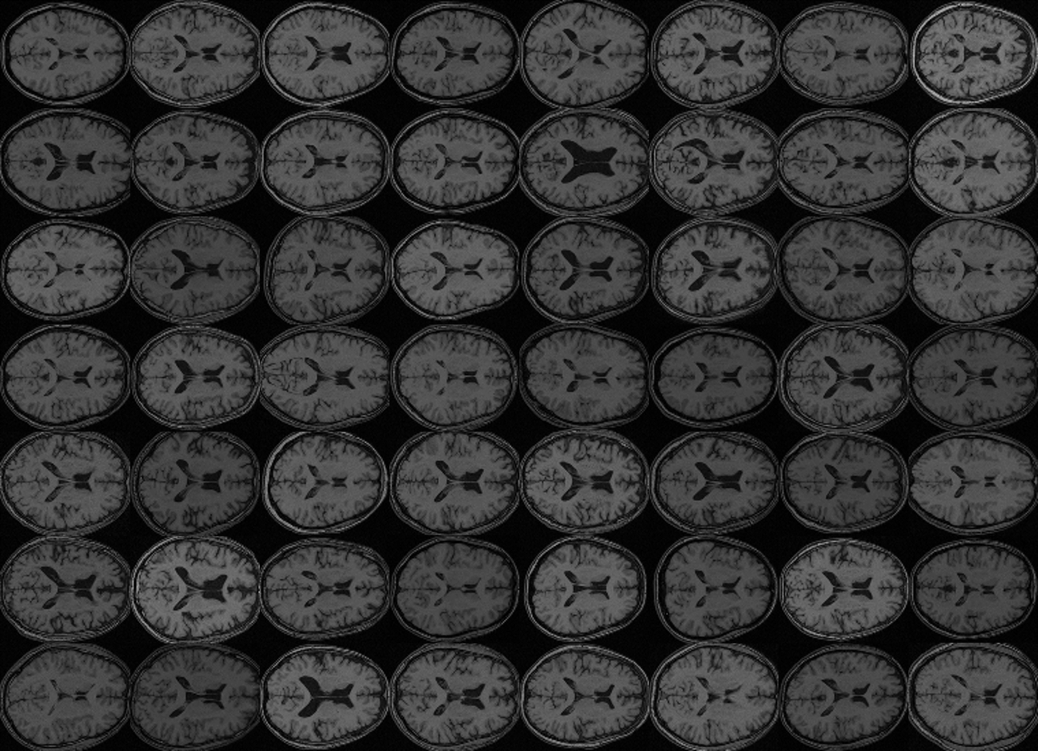 brain_bigdata